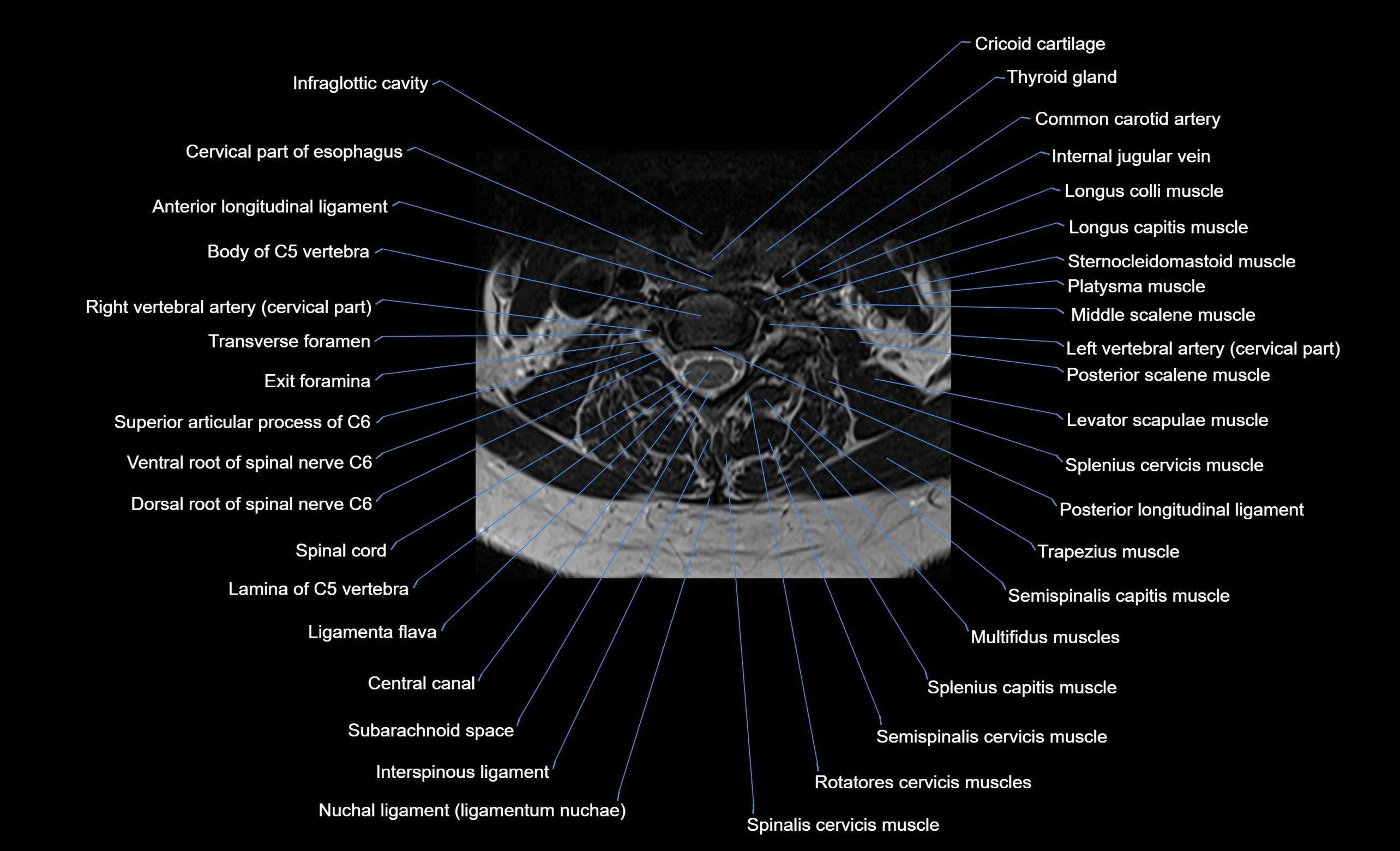 cervical spine cross sectional MRI anatomy  3T MRI axial  image-img-00001-00028.webp